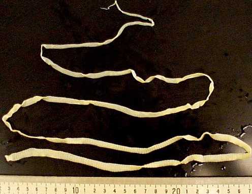60-foot tapeworm